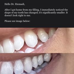 Shirin Etemadi, DDS - A Brilliant Smile - My email to Dr. Etemadi on 4/12 including the image of my disproportionate tooth and filling she did on 4/10