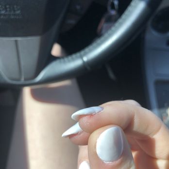 Bella Nails and Spa - Ripped nail bed and dent in nail bed - Nail Salons Near Me - Seattle, Washington