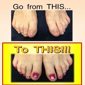 Tips N Toes - Dont be afraid of wearing those sandals ever again..... The magic of acrylic could change your life! Acrylic Nails are the bomb! - Nail Salons Near Me - Deer Park, Illinois