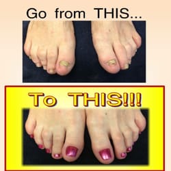 Tips N Toes - Dont be afraid of wearing those sandals ever again..... The magic of acrylic could change your life! Acrylic Nails are the bomb!