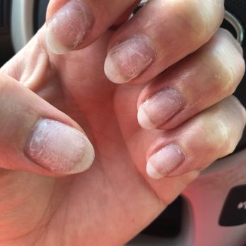 Nails Club - Nails after dip removal - Nail Salons Near Me - Bloomington, Indiana