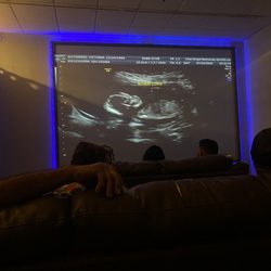 Mothers Precious Moments - 4D/HD Ultrasound - Cherished Memories