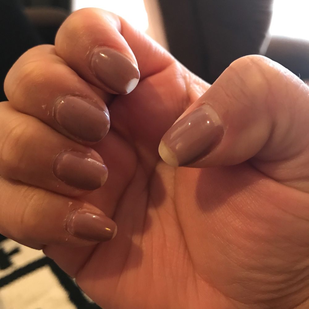 6 days after my gel manicure. I work in an office so I don't do anything too crazy that would cause for chipping to occur so fast. 6 days after my gel manicure. I work in an office so I don't do anything too crazy that would cause for chipping to occur so fast.