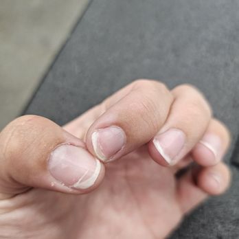 Hi Tek Nails - The crack in my thumb nails and bend lines on my pointer. - Nail Salons Near Me - Cerritos, California