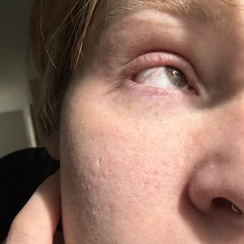 Shubh beauty - My natural lashes all patchy and now missing - Eyelash Service Near Me - Elizabethtown, Kentucky Shubh beauty - My natural lashes all patchy and now missing - Eyelash Service Near Me - Elizabethtown, Kentucky