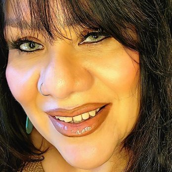 Biologi MD - Bruising was manageable - Medical Spas Near Me - Newport Beach, California