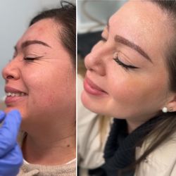 Regain your confidence with us!
.
Real Patient*Real Experience*Real Result