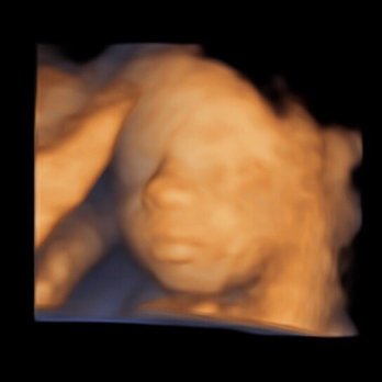 New Direction Fertility Centers - Baby boy - Endocrinologists Near Me - Gilbert, Arizona New Direction Fertility Centers - Baby boy - Endocrinologists Near Me - Gilbert, Arizona