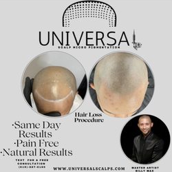 Universal Scalps - Follow on Instagram