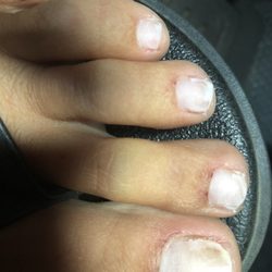 My cuticles have been sore now for 2 days . My toenails are ruined for awhile now . Absolutely ridiculous. They should be shut down