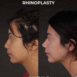 Cheng Plastic Surgery