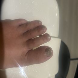 I've got the ugliest toes and John made them look much better I've got the ugliest toes and John made them look much better