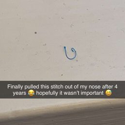 The stitch. The stitch.