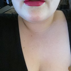 Monique J Wilson, MD - After our most recently visit in June 2020. Touch up filler to even out shape.This is the most even my lips have ever been!