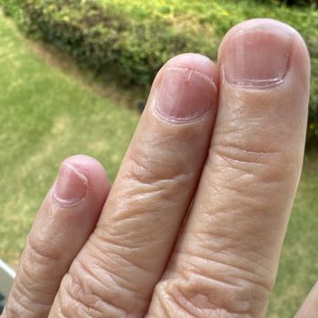 Aloha Nail Studio - Nail split & can see on bottom ridge how far nails were grounded down .. aren't they pretty - Nail Salons Near Me - Kapaa, Hawaii