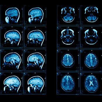 Lexington Medical Imaging - Diagnostic Imaging Near Me - Sugar Land, Texas Lexington Medical Imaging - Diagnostic Imaging Near Me - Sugar Land, Texas