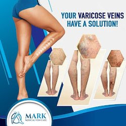 Mark Medical Care Vein & Fibroids