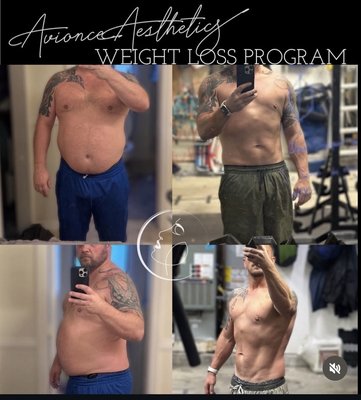 Medical Weight Loss Program - ​Medical weight loss program guided by a physician. Book your consultation today to see what option may work best for you.