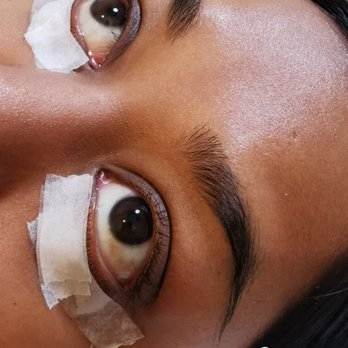 Beauty By Jade - Before - Teeth Whitening Near Me - Vaughan, Ontario