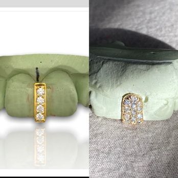 Houston Texas Grillz - Jewelry Near Me - Houston, Texas Houston Texas Grillz - Jewelry Near Me - Houston, Texas