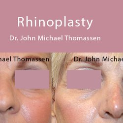 John Michael Thomassen, MD - Fort Lauderdale Plastic Surgery by Dr. John Michael Thomassen - Board Certified Plastic Surgeon...