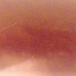 NRAD - AGAIN, ANOTHER PHOTO OF THE JAGGED BLOODY CUT