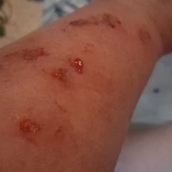 Metro Health - Teach your so called Dr's they need a course of get your head out of your butt