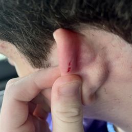 Careless. Tore a chunk out of my kid's ear with their shaver today. Hold the ear back when you use a shaver in that area!