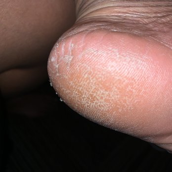 Him & Her Nail Spa - Omg what did that lady do to my feet?!?! - Nail Technicians Near Me - Atlanta, Georgia Him & Her Nail Spa - Omg what did that lady do to my feet?!?! - Nail Technicians Near Me - Atlanta, Georgia