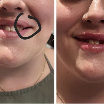 Looking Younger Aesthetics - Medical Spas Near Me - Wantagh, New York Looking Younger Aesthetics - Medical Spas Near Me - Wantagh, New York