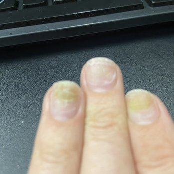 A & J Nails Spa - Nail fungus - Nail Salons Near Me - Indio, California