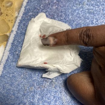 Lux Nails - Injured with drill - Nail Salons Near Me - Chester, Virginia