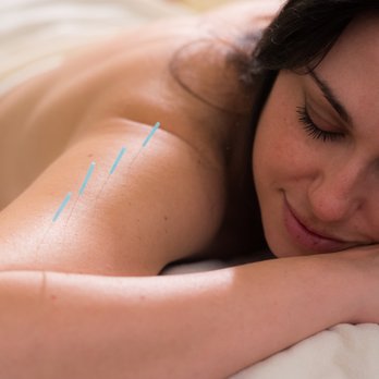 Prinz Acupuncture - Specialties include physical pain & injury, women's health, and emotional issues. - Acupuncture Near Me - New York, New York Prinz Acupuncture - Specialties include physical pain & injury, women's health, and emotional issues. - Acupuncture Near Me - New York, New York