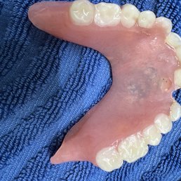 Poorly made denture made by Dr. Boone Poorly made denture made by Dr. Boone