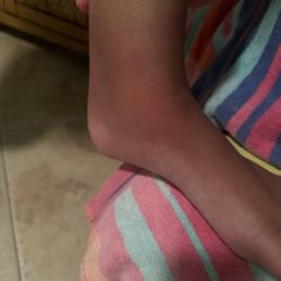The kids got severally infected.