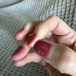 Polish all over my skin and rough skin from cutting my nails too short then filing my skin as she files the nail