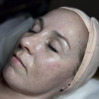 Softtouch Studio Med Spa - Glowy, hydrated results - Medical Spas Near Me - Las Vegas, Nevada