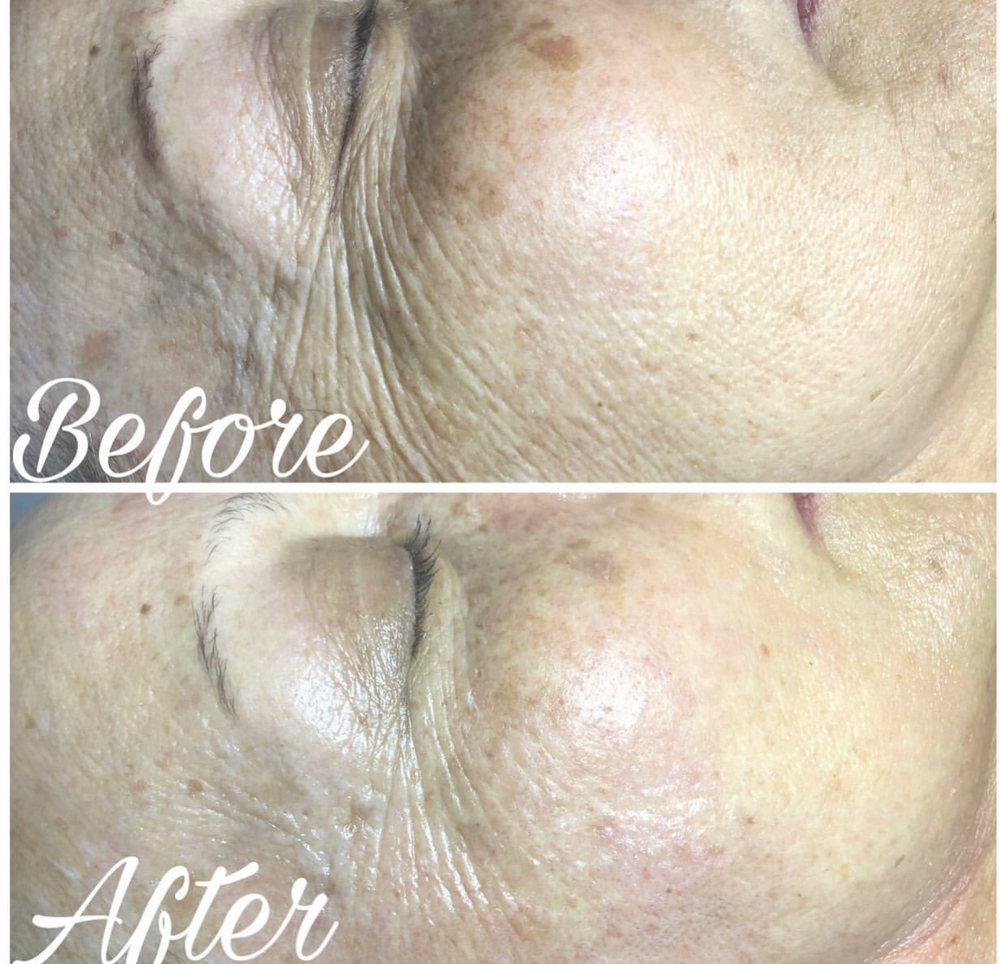 UNIQUE SKIN CARE Updated June 2024 52 Photos & 88 Reviews 141 W