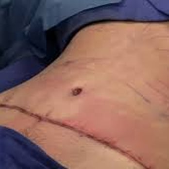Brian Murray, MD - Cosmetic Surgeons Near Me - Waukegan, Illinois Brian Murray, MD - Cosmetic Surgeons Near Me - Waukegan, Illinois