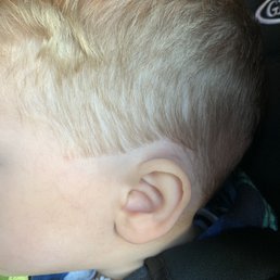 Completely uneven, not blended, and jagged edges Completely uneven, not blended, and jagged edges