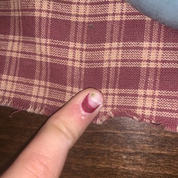 Road 68 Nails - The greenish yellow spot on my nail is the infection. - Nail Salons Near Me - Pasco, Washington