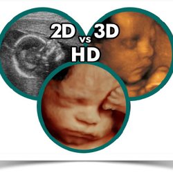 In The Womb View