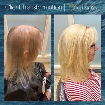 Allusions Hair Replacement Studio - Hair Loss Centers Near Me - Cincinnati, Ohio Allusions Hair Replacement Studio - Hair Loss Centers Near Me - Cincinnati, Ohio