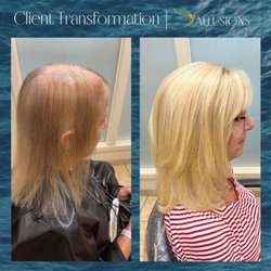 Allusions Hair Replacement Studio