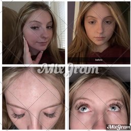 Before & after