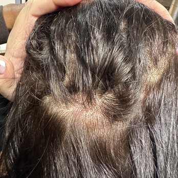 Ulta Beauty - More BURNT SCALP - Hair Salons Near Me - Patchogue, New York