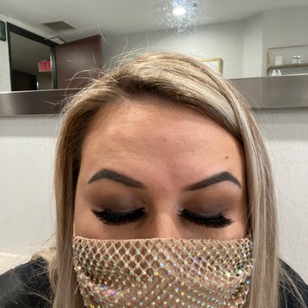 The Image Center - Post Botox in forehead - Plastic Surgeons Near Me - Irvine, California