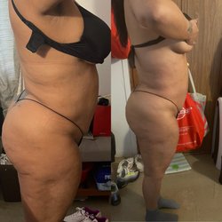Snatched By Mari 1218 - This client received 4 treatments of Messolipo treatment to assist in targeting stubborn fat.