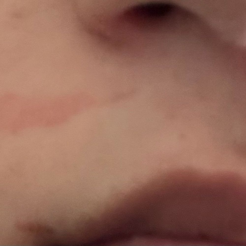 Lip wax results in skin missing