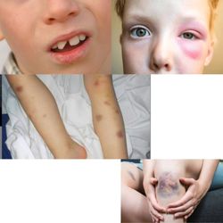 Harsha Behavioral Center - I have gotten with some parents who had there kids in there and they were kind enough to share these pics with me when there child came out.